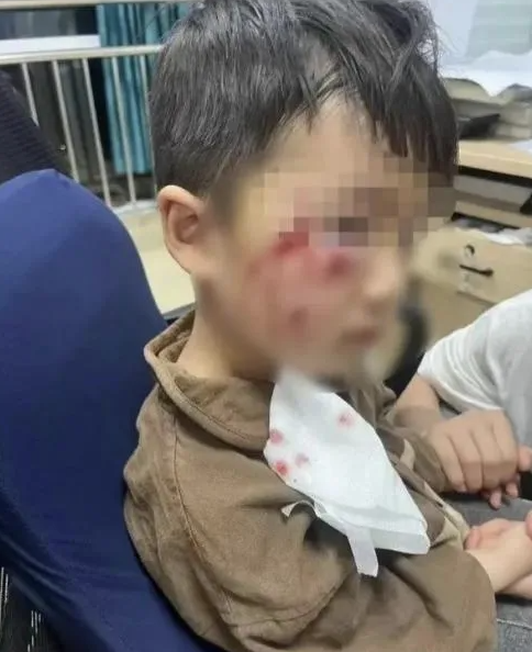 被瘋?cè)麤](méi)有“救命藥”，怎么辦？